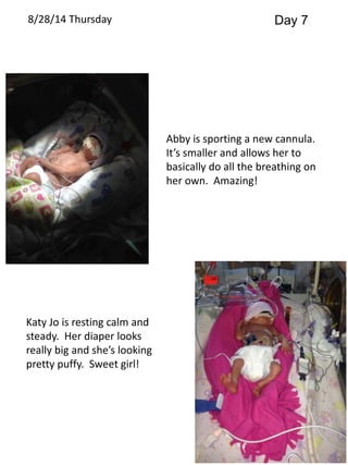 8/28/14 Thursday Day 7 
Abby is sporting a new cannula. 
It’s smaller and allows her to 
basically do all the breathing on 
her own. Amazing! 
Katy Jo is resting calm and 
steady. Her diaper looks 
really big and she’s looking 
pretty puffy. Sweet girl! 
 