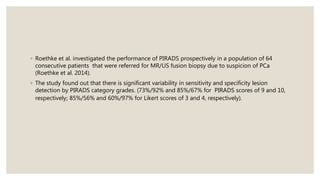 ◦ Roethke et al. investigated the performance of PIRADS prospectively in a population of 64
consecutive patients that were referred for MR/US fusion biopsy due to suspicion of PCa
(Roethke et al. 2014).
◦ The study found out that there is significant variability in sensitivity and specificity lesion
detection by PIRADS category grades. (73%/92% and 85%/67% for PIRADS scores of 9 and 10,
respectively; 85%/56% and 60%/97% for Likert scores of 3 and 4, respectively).
 