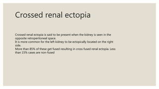 Crossed renal ectopia
Crossed renal ectopia is said to be present when the kidney is seen in the
opposite retroperitoneal space.
It is more common for the left kidney to be ectopically located on the right
side.
More than 85% of these get fused resulting in cross fused renal ectopia. Less
than 15% cases are non-fused
 