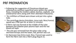 PRF PREPARATION
• Following the suggestion of Choukroun,blood was
collected via common superficial veins within the cubital
fossa, including the median cubital, basilica, cephalic, and
antebrachial veins along with their attendant tributaries.
• Ten milliliters of blood were drawn and put into a glass
tube.
• The centrifuge device (IntraSpin, Intra-Lock, Nice,France)
speed was 2700 rpm for at least 12 minutes.
• A fibrin clot was formed at the middle of the tube
between the platelet-poor plasma layer and the red
blood cell layer.
• The clot was removed from the glass tube using
sterilized forceps and the lower, red, portion was cut.
• An Xpression box (Intra-Lock, Nice, France) was used to
form the fibrin clot into a fibrin plug (Figure 2).
 