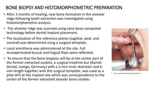 BONE BIOPSY AND HISTOMORPHOMETRIC PREPARATION
• After 2 months of healing, new bone formation in the alveolar
ridge following tooth extraction was investigated using
histomorphometric analysis.
• The alveolar ridge was scanned using cone-bean computed
technology before dental implant placement.
• The localization of the reference planes (sagittal, axial, and
coronal) was determined using a surgical template.
• Local anesthesia was administered at the site. Full
mucoperiosteal buccal and lingual flaps were reflected.
• To ensure that the bone biopsies will be at the center part of
the former extracted sockets, a surgical trephine bur (Komet
Dental, Lemgo, Germany) with a 2-mm inner diameter and 6-
mm length together with the surgical template, was used as a
pilot drill at the implant site which was correspondence to the
center of the former extracted alveolar bone sockets
 