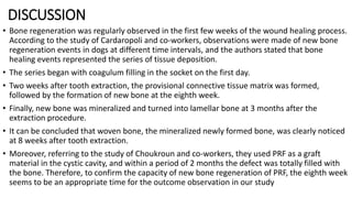 DISCUSSION
• Bone regeneration was regularly observed in the first few weeks of the wound healing process.
According to the study of Cardaropoli and co-workers, observations were made of new bone
regeneration events in dogs at different time intervals, and the authors stated that bone
healing events represented the series of tissue deposition.
• The series began with coagulum filling in the socket on the first day.
• Two weeks after tooth extraction, the provisional connective tissue matrix was formed,
followed by the formation of new bone at the eighth week.
• Finally, new bone was mineralized and turned into lamellar bone at 3 months after the
extraction procedure.
• It can be concluded that woven bone, the mineralized newly formed bone, was clearly noticed
at 8 weeks after tooth extraction.
• Moreover, referring to the study of Choukroun and co-workers, they used PRF as a graft
material in the cystic cavity, and within a period of 2 months the defect was totally filled with
the bone. Therefore, to confirm the capacity of new bone regeneration of PRF, the eighth week
seems to be an appropriate time for the outcome observation in our study
 