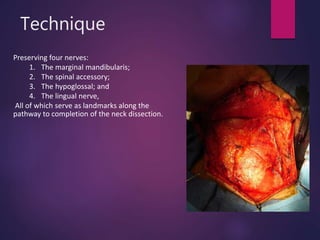Technique
Preserving four nerves:
1. The marginal mandibularis;
2. The spinal accessory;
3. The hypoglossal; and
4. The lingual nerve,
All of which serve as landmarks along the
pathway to completion of the neck dissection.
 