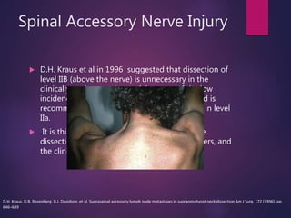Spinal Accessory Nerve Injury
 D.H. Kraus et al in 1996 suggested that dissection of
level IIB (above the nerve) is unnecessary in the
clinically node-negative neck because of the low
incidence of metastases in this area (1.6%), and is
recommended only if bulky disease is present in level
IIa.
 It is this author's practice to exclude extensive
dissection of this area in most oral cavity cancers, and
the clinically N0 neck.
D.H. Kraus, D.B. Rosenberg, B.J. Davidson, et al. Supraspinal accessory lymph node metastases in supraomohyoid neck dissection Am J Surg, 172 (1996), pp.
646–649
 
