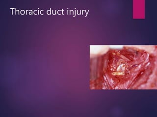 Thoracic duct injury
 