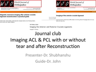 Journal club
Imaging ACL & PCL with or without
tear and after Reconstruction
Presenter-Dr. Shubhanshu
Guide-Dr. John
 