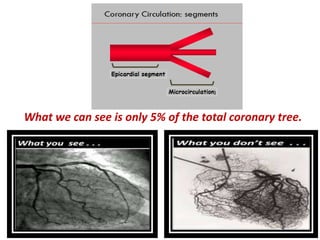 What we can see is only 5% of the total coronary tree.
 