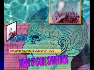 MIXED BIPOLAR EPISODE-SYMPTOMS MIXED EPISODE SYMPTOMS 