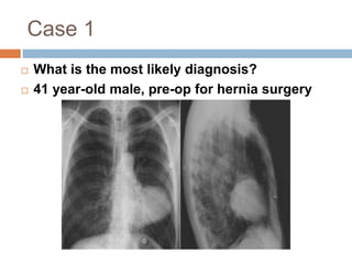 Case 1 
 What is the most likely diagnosis? 
 41 year-old male, pre-op for hernia surgery 
 