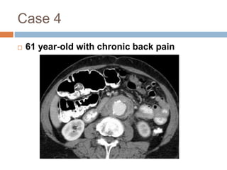 Case 4 
 61 year-old with chronic back pain 
 