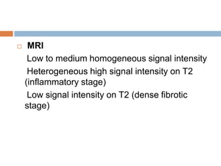  MRI 
Low to medium homogeneous signal intensity 
Heterogeneous high signal intensity on T2 
(inflammatory stage) 
Low signal intensity on T2 (dense fibrotic 
stage) 
 
