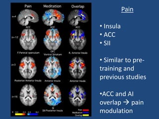 Pain
• Insula
• ACC
• SII
• Similar to pre-
training and
previous studies
•ACC and AI
overlap  pain
modulation
 