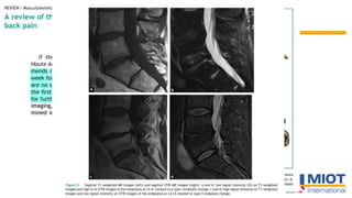 Segmented Sign Journal club | PPTX