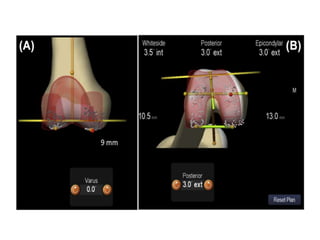 Meridium Bench Alignment Journal club on Alignment and Balance Methods in - Copy.pptx