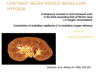 A temporary increase in renal transport work
in the thick ascending limb of Henle's loop
( in oxygen consumption)
+
Constriction of medullary capillaries ( in medullary oxygen delivery)
LEAD TO
MEDULLARY ANGINA
Solomon, et al. Kidney Int 1998; 230-242
 