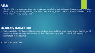 omfs journal club ppt on bone ridge augmentation | PPTX