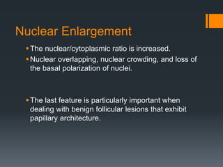Nuclear Enlargement
The nuclear/cytoplasmic ratio is increased.
Nuclear overlapping, nuclear crowding, and loss of
the basal polarization of nuclei.
The last feature is particularly important when
dealing with benign follicular lesions that exhibit
papillary architecture.
 