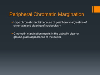 Peripheral Chromatin Margination
 Hypo chromatic nuclei because of peripheral margination of
chromatin and clearing of nucleoplasm
 Chromatin margination results in the optically clear or
ground-glass appearance of the nuclei.
 