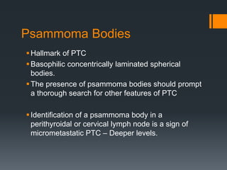 Psammoma Bodies
Hallmark of PTC
Basophilic concentrically laminated spherical
bodies.
The presence of psammoma bodies should prompt
a thorough search for other features of PTC
Identification of a psammoma body in a
perithyroidal or cervical lymph node is a sign of
micrometastatic PTC – Deeper levels.
 