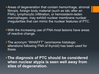Areas of degeneration that contain hemorrhage, stromal
fibrosis, foreign body material (such as talc after an
FNA), lymphocytic infiltration, or hemosiderin-laden
macrophages, may exhibit nuclear membrane nuclear
irregularities that can mimic the nuclear features of PTC.
With the increasing use of FNA most lesions have areas
of reactive change.
The acronym “WHAFFT” (worrisome histologic
alterations following FNA of thyroid) has been used for
these.
The diagnosis of PTC should be considered
when nuclear atypia is seen well away from
sites of degeneration.
 