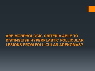 ARE MORPHOLOGIC CRITERIA ABLE TO
DISTINGUISH HYPERPLASTIC FOLLICULAR
LESIONS FROM FOLLICULAR ADENOMAS?
 