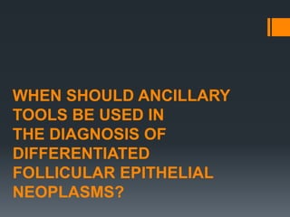 WHEN SHOULD ANCILLARY
TOOLS BE USED IN
THE DIAGNOSIS OF
DIFFERENTIATED
FOLLICULAR EPITHELIAL
NEOPLASMS?
 