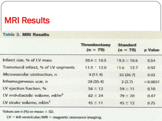MRI Results
 