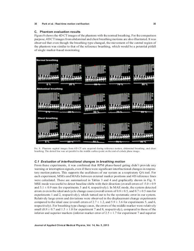 Journal of applied clinical medical physics Vol 14, No 5 (2013)