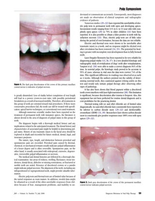 Inconistent Teeth Journal of endodontics | PDF