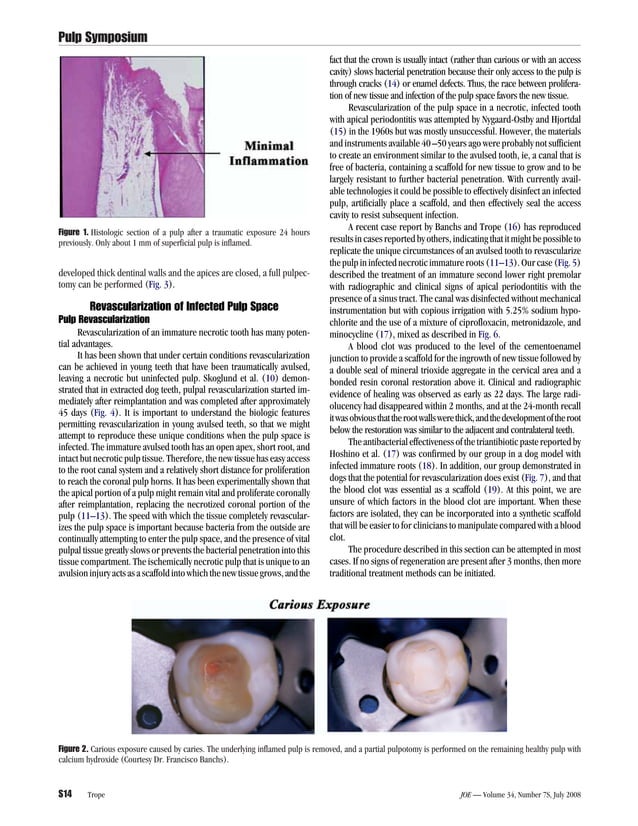 Journal of endodontics