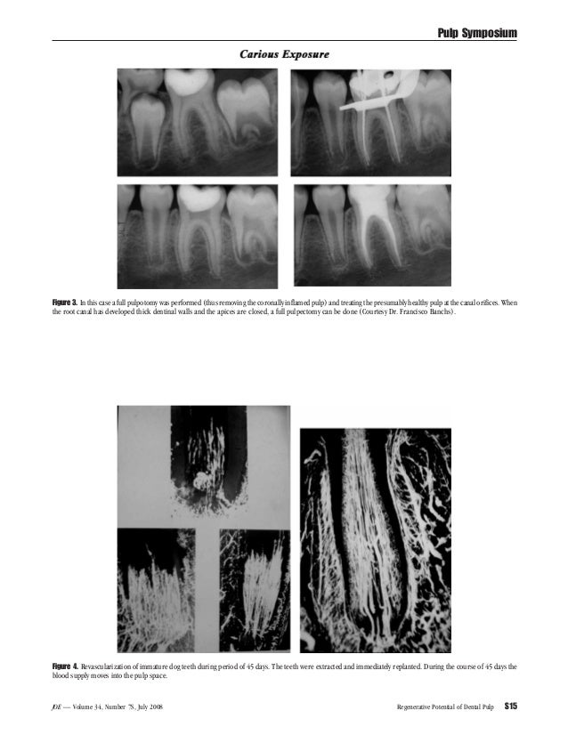Journal of endodontics