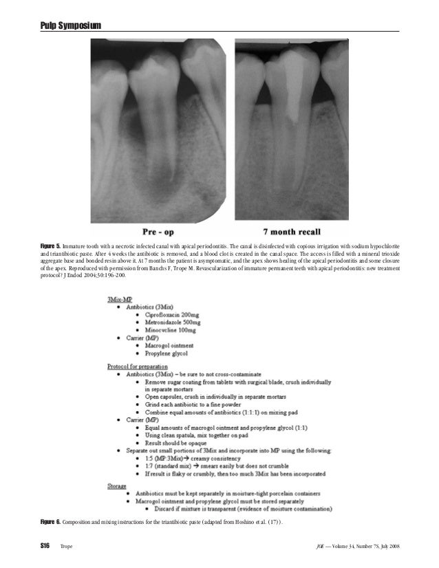 Journal of endodontics