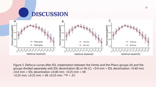 DISCUSSION
33
igure 3. Defocus curves after IOL implantation between the Femto and the Phaco groups (A) and the groups divided separately with
IOL decentration (B) or tilt (C). <0.4 mm = IOL decentration <0.40 mm; ≥0.4 mm = IOL decentration ≥0.40 mm; <0.25 mm = tilt
<0.25 mm; ≥0.25 mm = tilt ≥0.25 mm. **P < .01.
Figure 3. Defocus curves after IOL implantation between the Femto and the Phaco groups (A) and the
groups divided separately with IOL decentration (B) or tilt (C). <0.4 mm = IOL decentration <0.40 mm;
≥0.4 mm = IOL decentration ≥0.40 mm; <0.25 mm = tilt
<0.25 mm; ≥0.25 mm = tilt ≥0.25 mm. **P < .01.
 