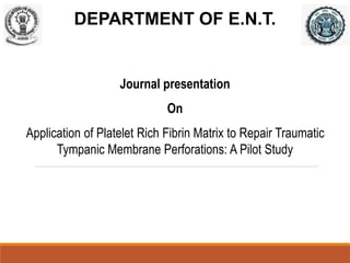 Journal presentation
On
Application of Platelet Rich Fibrin Matrix to Repair Traumatic
Tympanic Membrane Perforations: A Pilot Study
DEPARTMENT OF E.N.T.
 