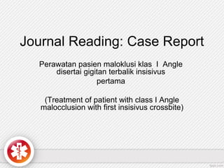 Journal Reading: Case Report
Perawatan pasien maloklusi klas I Angle
disertai gigitan terbalik insisivus
pertama
(Treatment of patient with class I Angle
malocclusion with first insisivus crossbite)
 