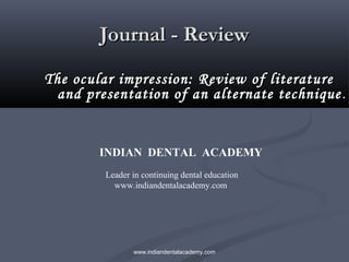 Journal - Review
The ocular impression: Review of literature
and presentation of an alternate technique .

INDIAN DENTAL ACADEMY
Leader in continuing dental education
www.indiandentalacademy.com

www.indiandentalacademy.com

 