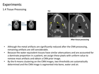 Convolutional neural network based metal artifact reduction in x ray ...