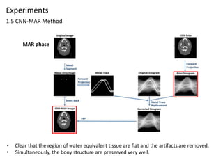 Convolutional neural network based metal artifact reduction in x ray ...