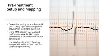 Accelerated Repetitive Transcranial Magnetic Stimulation for Post ...
