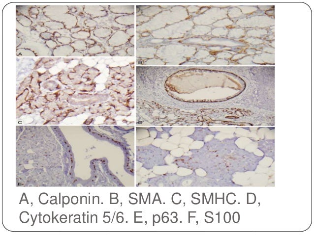 Review And Updates Of Immunohistochemistry In Selected Salivary Gland Review And Updates Of Immunohistochemistry In Selected Salivary Gland