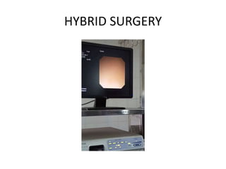 HYBRID SURGERY
 