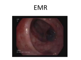 EMR
 