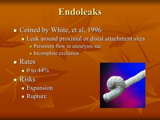Endoleaks
 Coined by White, et al, 1996
 Leak around proximal or distal attachment sites
 Persistent flow in aneurysm sac
 Incomplete exclusion
 Rates
 0 to 44%
 Risks
 Expansion
 Rupture
 