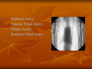 1. Popliteal Artery
2. Anterior Tibial Artery
3. Fibular Artery
4. Posterior Tibial Artery
 