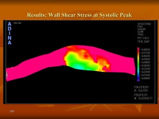 143
Results: Wall Shear Stress at Systolic Peak
 