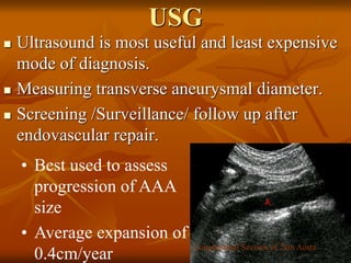 USG
 Ultrasound is most useful and least expensive
mode of diagnosis.
 Measuring transverse aneurysmal diameter.
 Screening /Surveillance/ follow up after
endovascular repair.
• Best used to assess
progression of AAA
size
• Average expansion of
0.4cm/year
Longitudinal Section of 2cm Aorta
 
