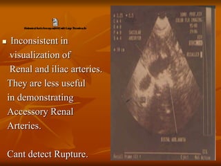  Inconsistent in
visualization of
Renal and iliac arteries.
They are less useful
in demonstrating
Accessory Renal
Arteries.
Cant detect Rupture.
 