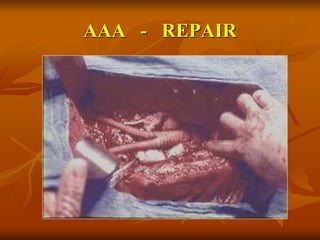 AAA - REPAIR
 