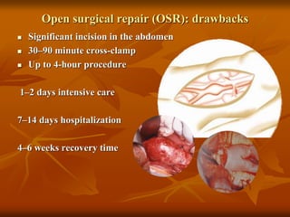 Open surgical repair (OSR): drawbacks
 Significant incision in the abdomen
 30–90 minute cross-clamp
 Up to 4-hour procedure
1–2 days intensive care
7–14 days hospitalization
4–6 weeks recovery time
 