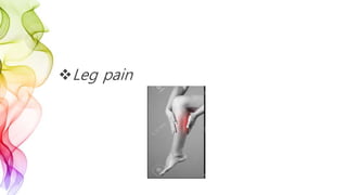 Leg pain
 